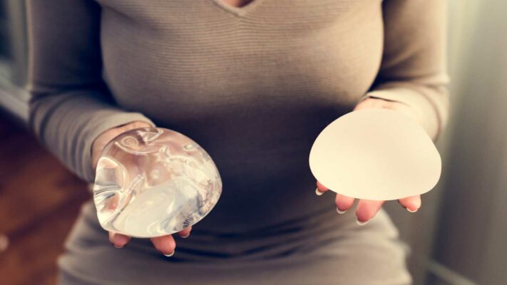 Lifespan of Breast Implants